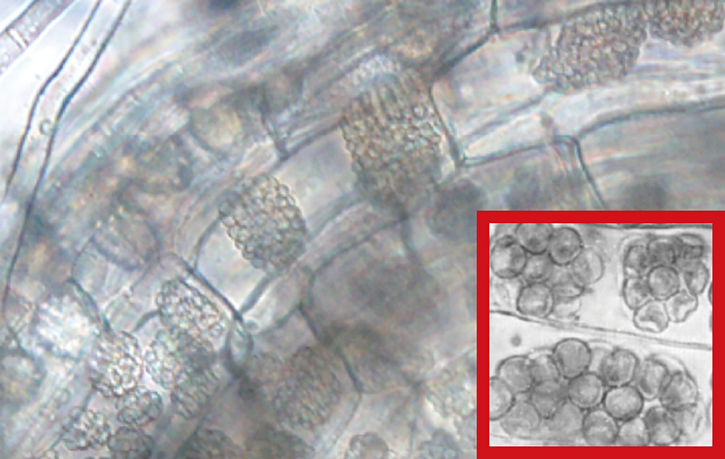 写真4.小麦の根（細根）にみられるポリミキサの休眠胞子