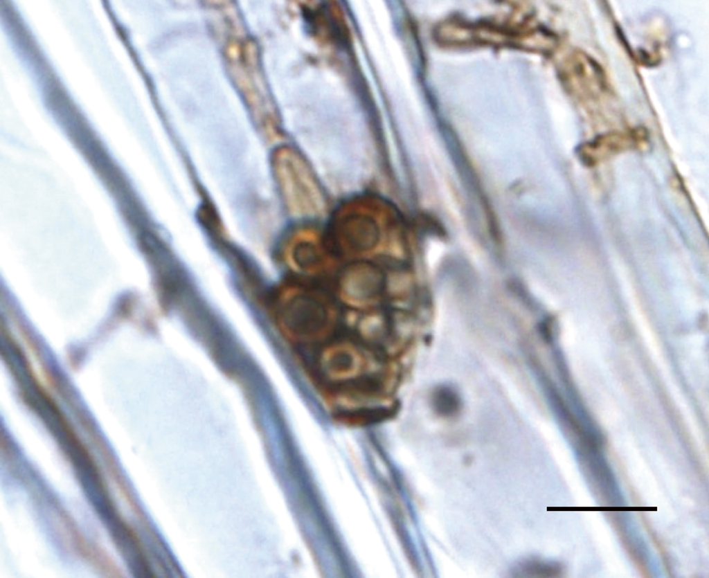 写真2.玉ねぎ根上の厚膜胞子 